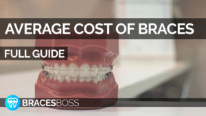 average cost of braces