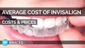 average cost of invisalign