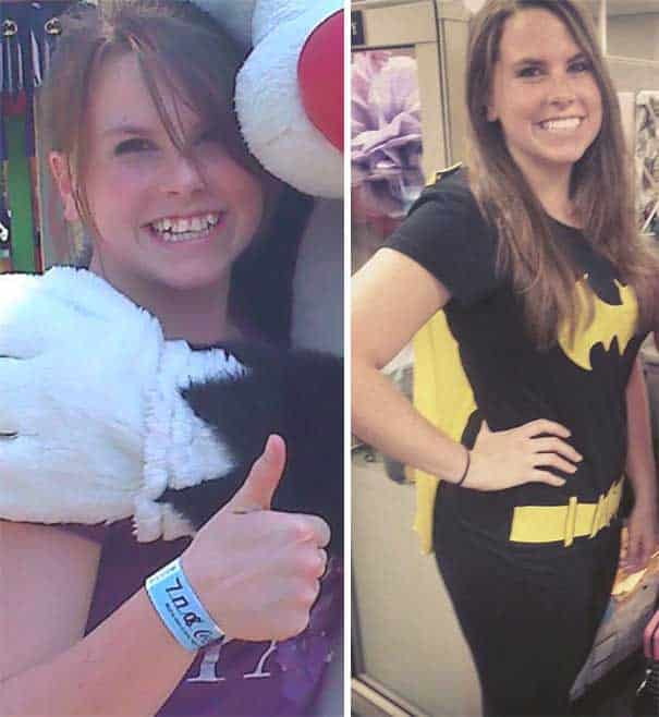 braces before and after adult example 2