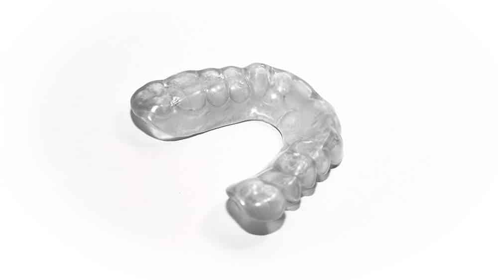 braces vs aligners