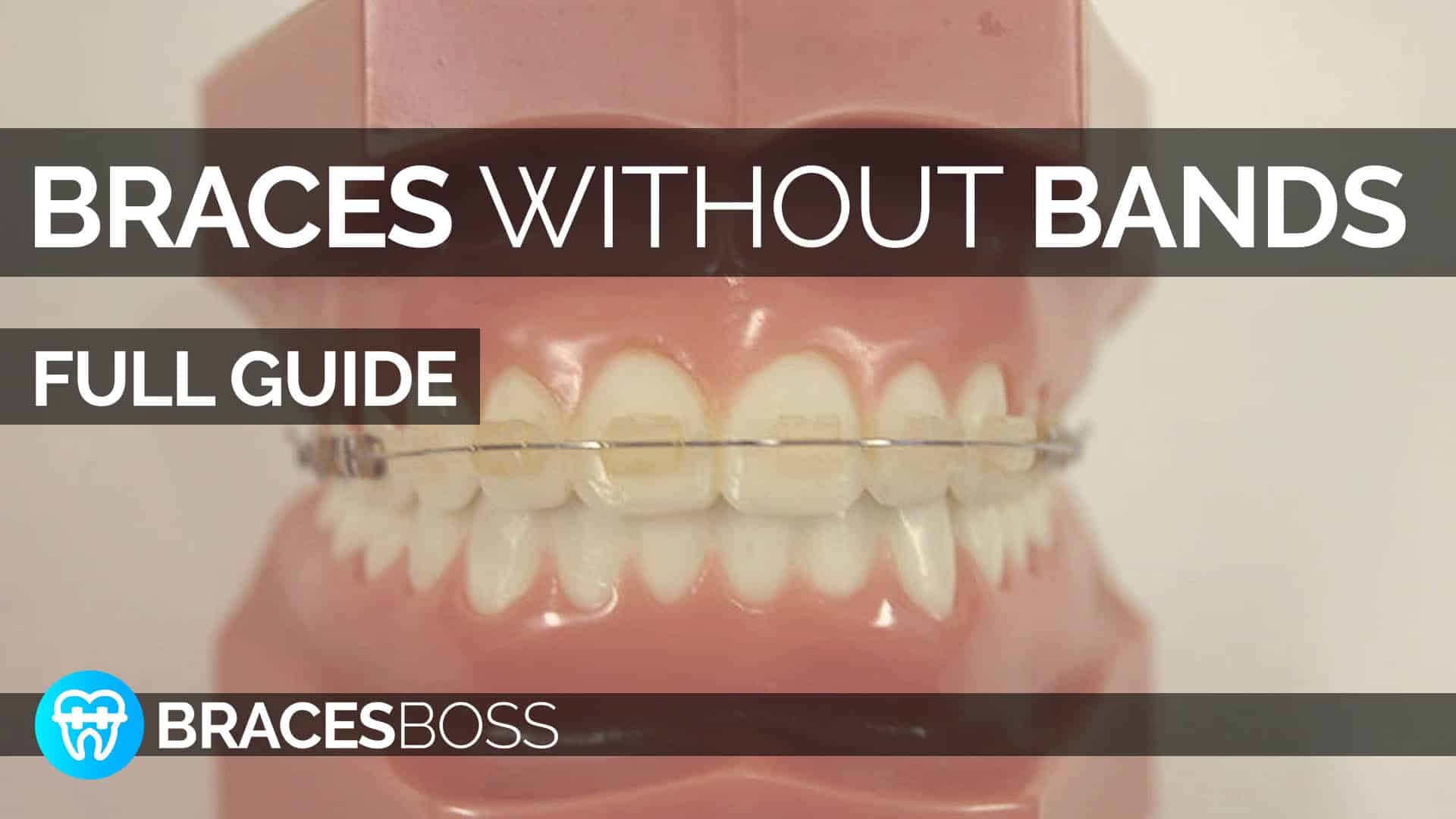 braces without bands