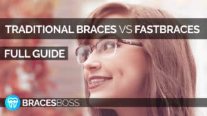 traditional braces vs fastbraces